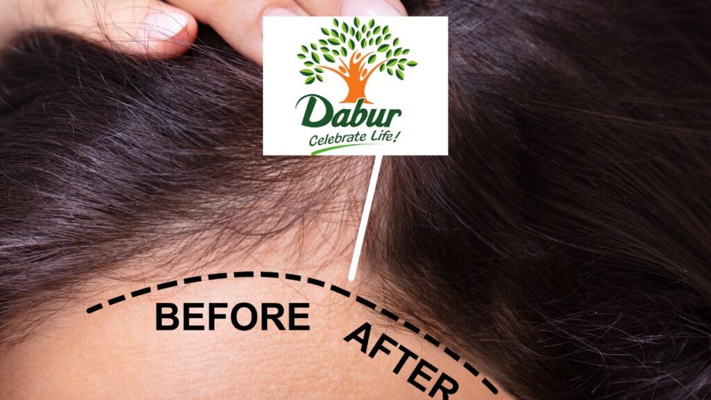 Dabur